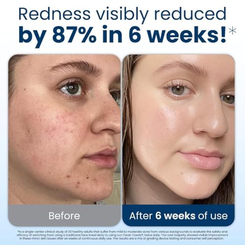 Serviettes nettoyantes Clean Skin Club XL®, 100 % biosourcées (USDA), jetables, approuvées par l'Eczema Association, lingettes sèches démaquillantes, ultra douces