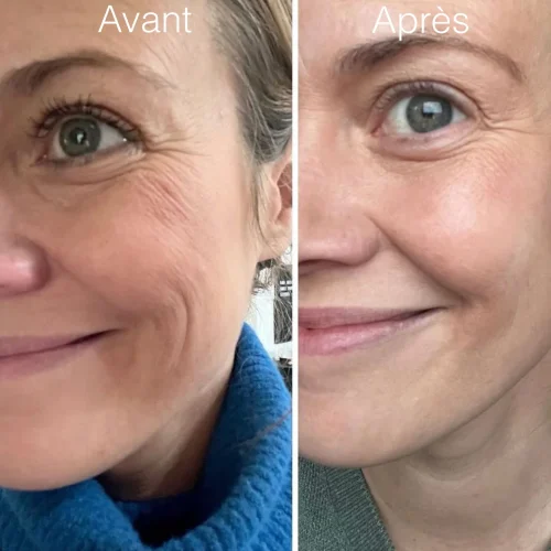 Crème de nuit anti-rides profondes RoC Retinol Correxion, soin anti-âge pour femmes et hommes, 28 g (l'emballage peut varier)