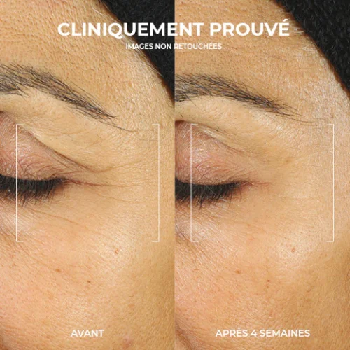 Crème de nuit anti-rides profondes RoC Retinol Correxion, soin anti-âge pour femmes et hommes, 28 g (l'emballage peut varier)