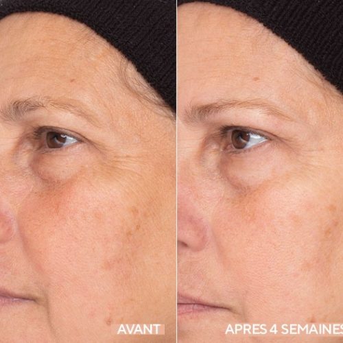 Crème de nuit anti-rides profondes RoC Retinol Correxion, soin anti-âge pour femmes et hommes, 28 g (l'emballage peut varier)