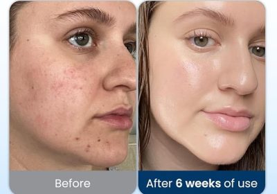 Serviettes nettoyantes Clean Skin Club XL®, 100 % biosourcées (USDA), jetables, approuvées par l'Eczema Association, lingettes sèches démaquillantes, ultra douces